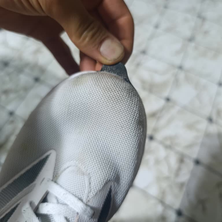 Adidas Ayakkabısının Ön Taban Açılması Ve Garanti Reddi