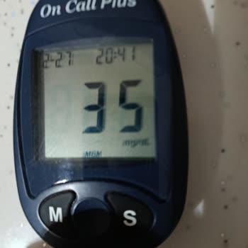 Apidra İnsülininin Etkisindeki Değişkenlik Ve Sürekli Hipoglisemi Sorunu