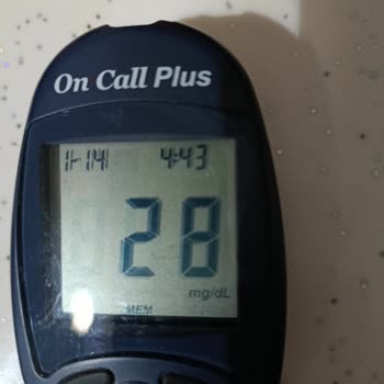 Apidra İnsülininin Etkisindeki Değişkenlik Ve Sürekli Hipoglisemi Sorunu