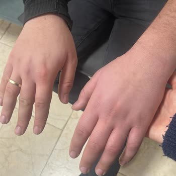 Acil Serviste Hastaya Müdahale Edilmemesi Ve Haksız Taburcu