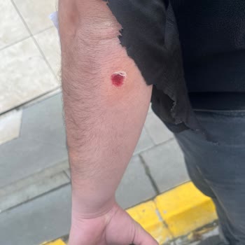 Acil Serviste Hastaya Müdahale Edilmemesi Ve Haksız Taburcu