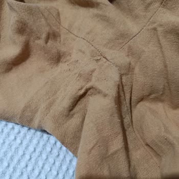 Kirli Ve Tüylenmiş Premium Pantolon İçin Haksız İade Reddi Ve Erişim Engeli