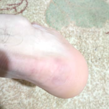 Ayıplı Topuk Dikişi İçin İade Reddi Ve Çelişkili Bilgi