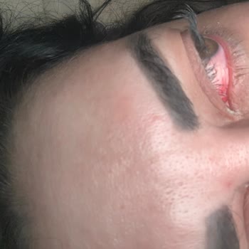 Fairy Kapsülü Patladı Gözüm Kızardı Ve Ürün Güvenliği Şikayetim