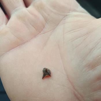 Erzurum A101'den Kekspır'da Dikenli Cisim Bulunması Güvenimi Sarstı