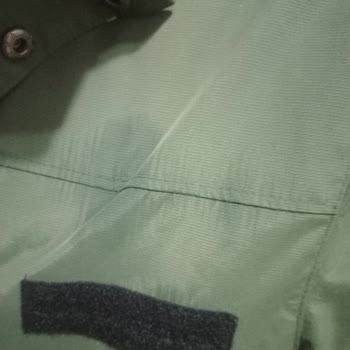 Aşırı Terleme Sorunu Ve Mağaza İlgisizliği