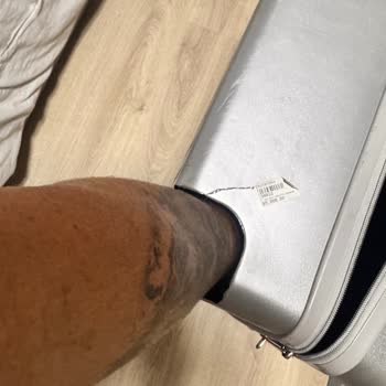 Parçalanmış Valiz Ve Eksik Hediyeler, THY Tazminat Reddetti