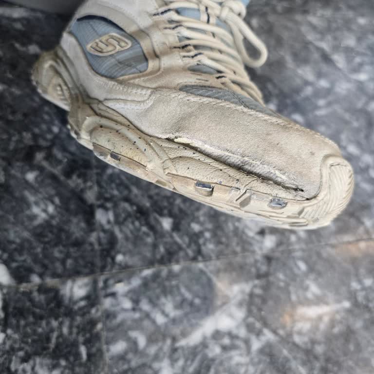 Skechers Markasından Aldığım Ayakkabılarda Kısa Sürede Deformasyon Ve Yırtılma!