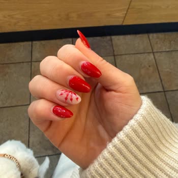 Randevuya 5 Dakika Geç Kalınca 1,5 Saat Bekletilmesi Ve Özel Günün Mahvolması