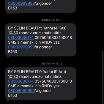 Randevuya 5 Dakika Geç Kalınca 1,5 Saat Bekletilmesi Ve Özel Günün Mahvolması