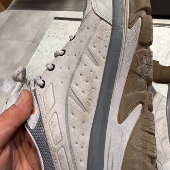 Skechers Ayakkabısında Temizlik Köpüğüyle Bile Giderilmeyen Lekeler Ve Çözüm Yokluğu