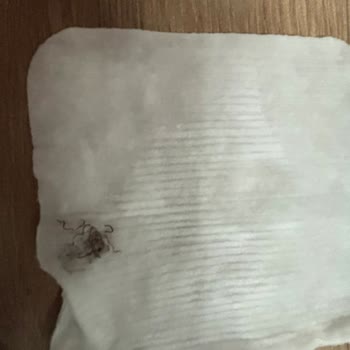 Baby Me Temizleme Pamuklarında Zımba Parçası Çıktı