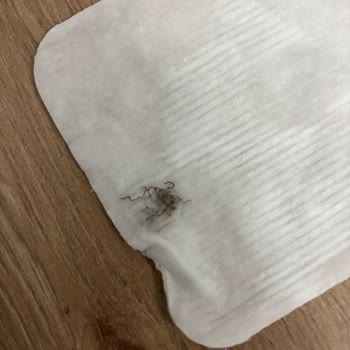 Baby Me Temizleme Pamuklarında Zımba Parçası Çıktı