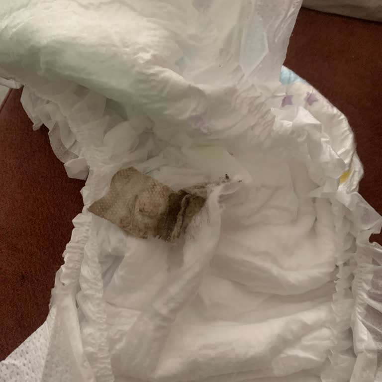 Molfix Bebek Bezinde Tozlu Kalıntı Hijyen Endişesi