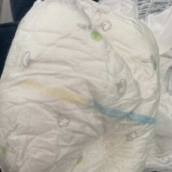 Sleepy Natural Külot Bezinde Sürekli Sızıntı Ve Gece Uykusunun Bölünmesi