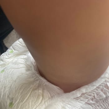 Sleepy Natural Külot Bezinde Sürekli Sızıntı Ve Gece Uykusunun Bölünmesi