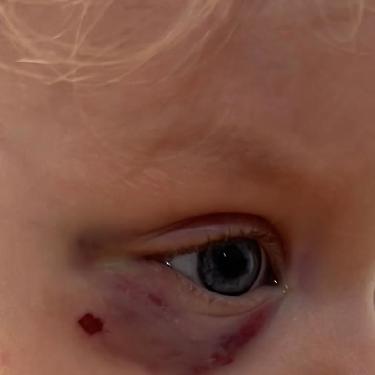 Playland’da Tekrarlanan Güvenlik İhmali Çocuğumun Gözüne Darbe