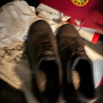 Ayağımı Yakan Ayakkabının İadesi İçin Cevap Bekliyorum