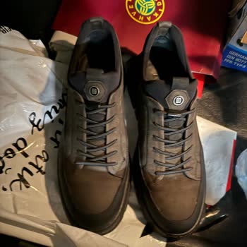 Ayağımı Yakan Ayakkabının İadesi İçin Cevap Bekliyorum