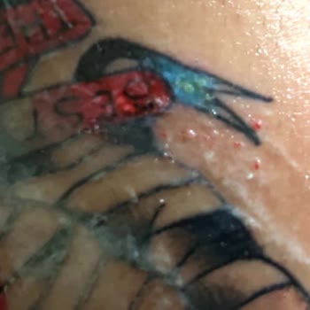 Nox Tattoo & Piercing Dövme Patlaması, Ciddi Yara Ve İlgisizlik