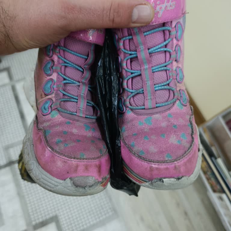 Skechers Botunda 45 Günde Parçalanma Ve İade Talebi