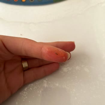 Dr. Oetker Toz Sosunda Metal Parça Çıktı Ve Çocuk Sağlığı Tehlikede