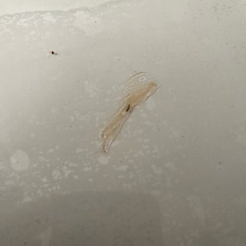 Dr. Oetker Toz Sosunda Metal Parça Çıktı Ve Çocuk Sağlığı Tehlikede