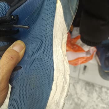 Skechers Ayakkabısının Kısa Sürede Yırtılması Ve Kullanıcı Hatası Reddi