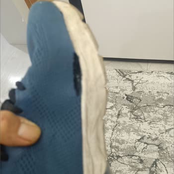 Skechers Ayakkabısının Kısa Sürede Yırtılması Ve Kullanıcı Hatası Reddi