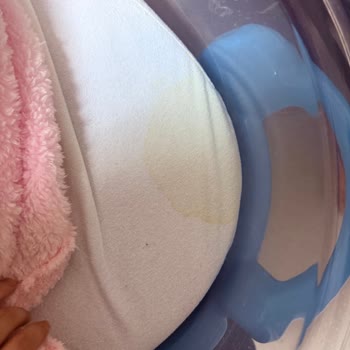 Urla Devlet Hastanesi Kadın Doğum Bölümünde Hijyen Eksikliği Ve Saygısız Hasta Bakımı