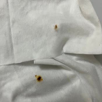 Pas Lekeli Temizlik Havlusunda Sağlık Riskleri Ve Açıklama Talebi