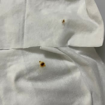 Pas Lekeli Temizlik Havlusunda Sağlık Riskleri Ve Açıklama Talebi