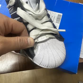 Adidas Superstar Ayakkabısındaki Açılma Ve Kullanıcı Hatası İddiası Reddi