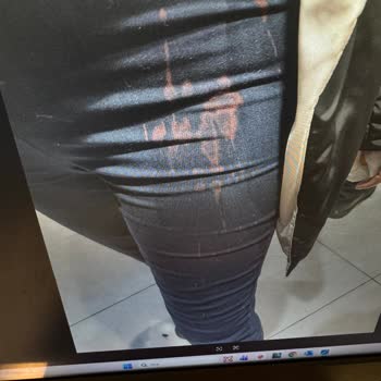 Üzerime Dökülen Ürünle Oluşan Kalıcı Lekeler Ve Kullanılamayan Telafi Kodu