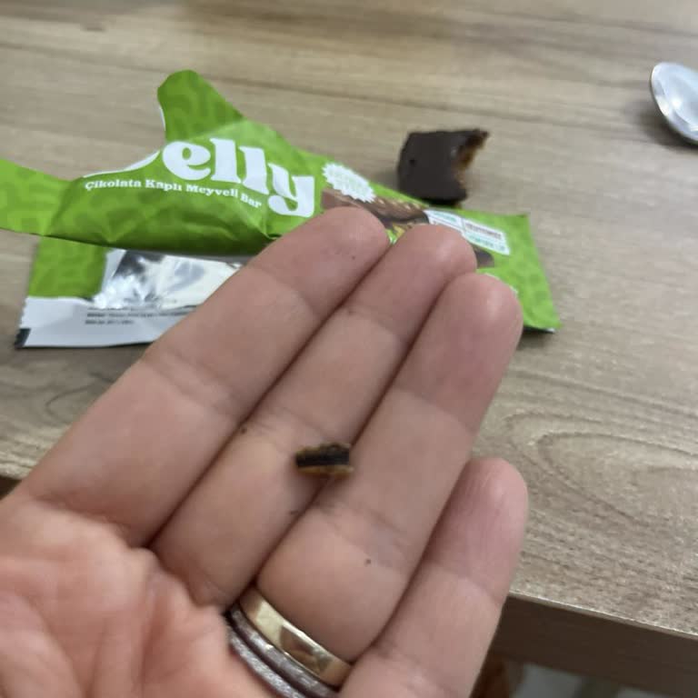 Çocuk Dişi Neredeyse Kırıldı Çikolata Barında Sert Yabancı Madde