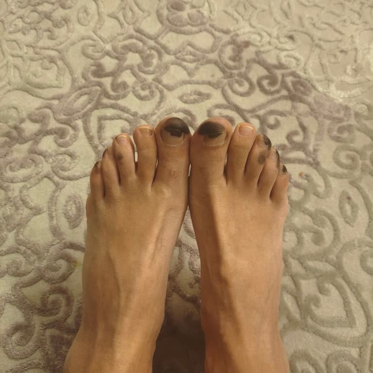 Botlarda Kimyasal Boya Lekesi Sağlık Riski Ve Geri Ödeme Talebi