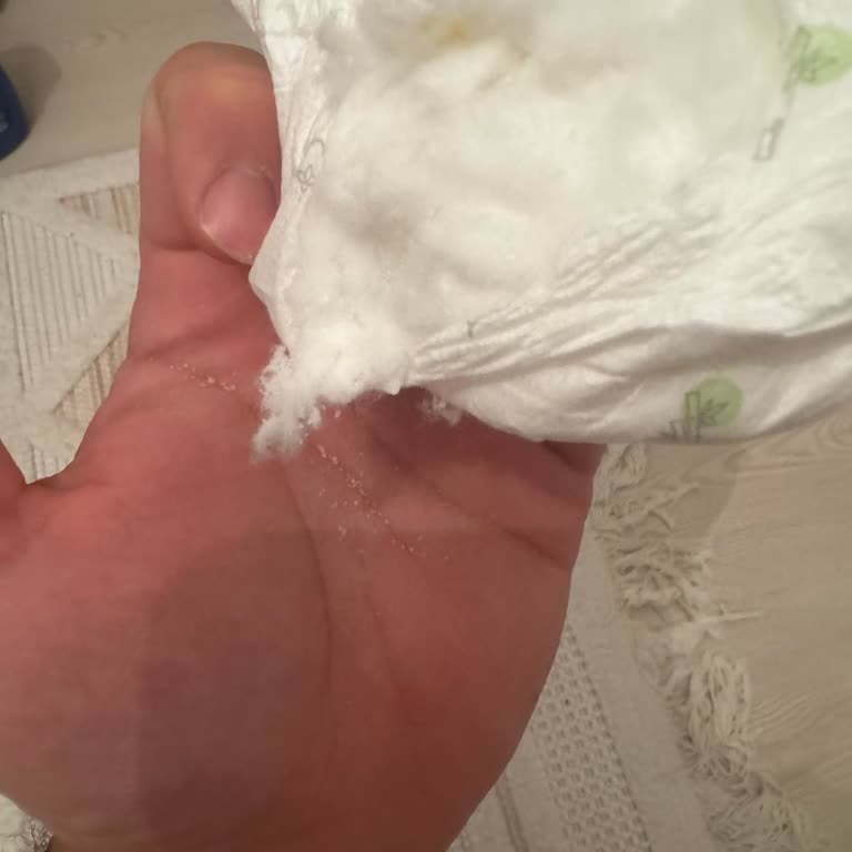 Sleepy Bebek Bezinde Kum Benzeri Madde Tespiti Ve Ürün Değişimi Talebi