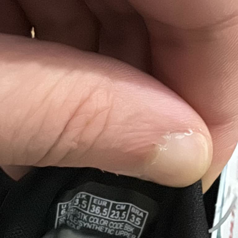 Yanlış Beden Gönderildi Ve Değişim Reddi