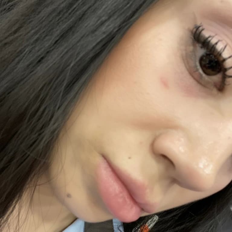 Watsons’ta Önerilen Göz Altı Serumu Alerjik Reaksiyon Ve İade Reddi