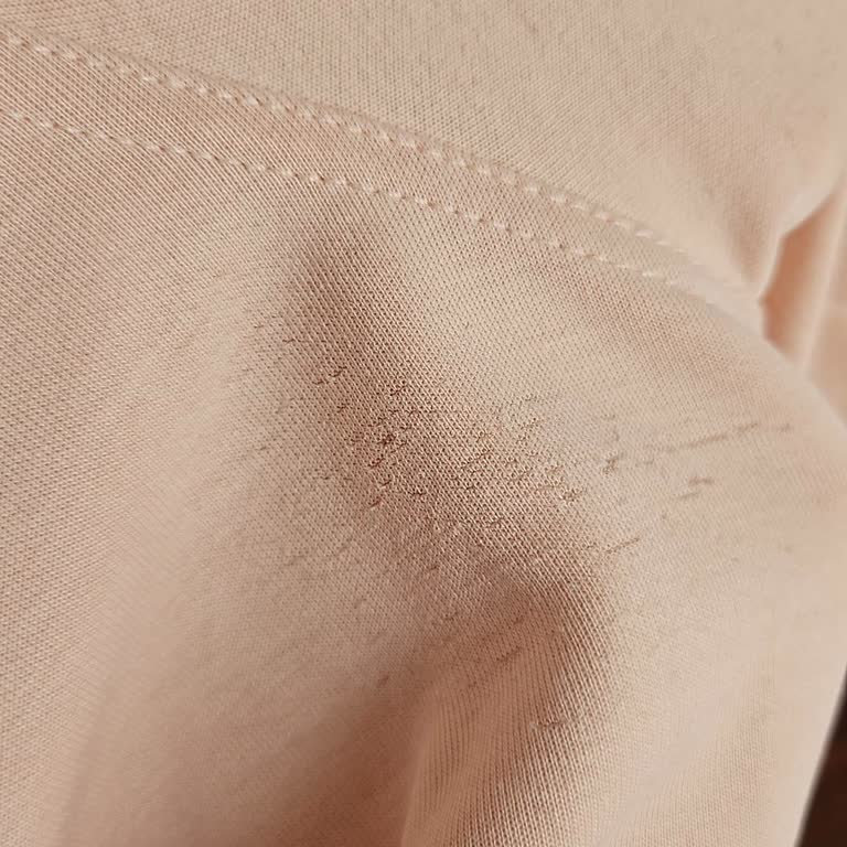 Reebok Mağazasında İlk Kullanımda Defolu Olan Kumaş Ve Ürün İadesi!