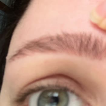 Kalitesiz Boya Nedeniyle Kalıcı Kızarıklık Ve Ücret İadesi Talebi