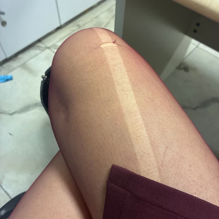 Defolu Çoraplar Ve İade Reddi İçin Hemen İade Talebi