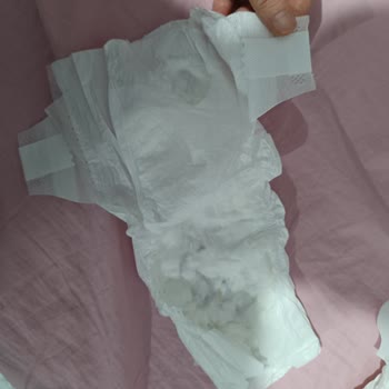 Pamukları Dökülen Bozuk Bebek Bezi İçin İade Talebi