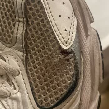 New Balance 530 Ayakkabısının Çift Yırtılması Ve Mağaza İlgisizliği