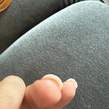 Arjin Demirtaş Müşteri Memnuniyetsizliği