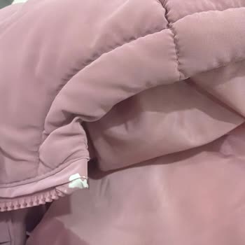 Mango Kids Çocuk Montu 1 Ayda Deri Soyulmuş, Değişim İstiyorum