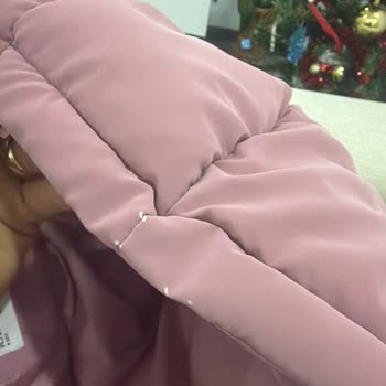 Mango Kids Çocuk Montu 1 Ayda Deri Soyulmuş, Değişim İstiyorum