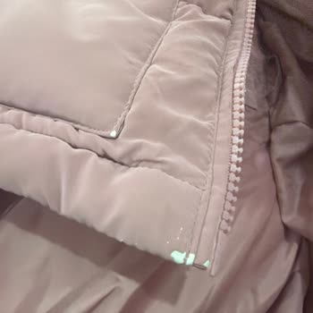 Mango Kids Çocuk Montu 1 Ayda Deri Soyulmuş, Değişim İstiyorum