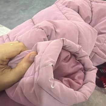 Mango Kids Çocuk Montu 1 Ayda Deri Soyulmuş, Değişim İstiyorum