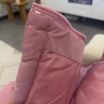 Mango Kids Çocuk Montu 1 Ayda Deri Soyulmuş, Değişim İstiyorum